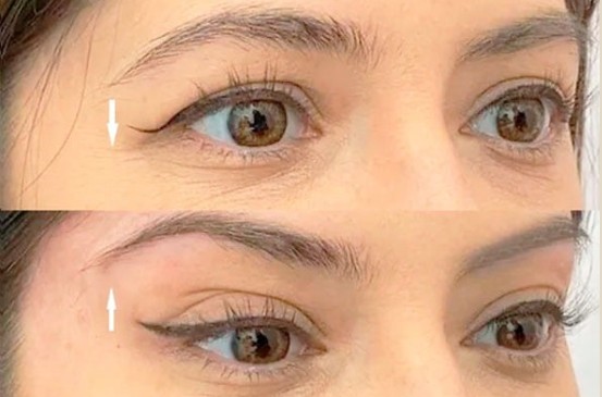 Fox Eyes